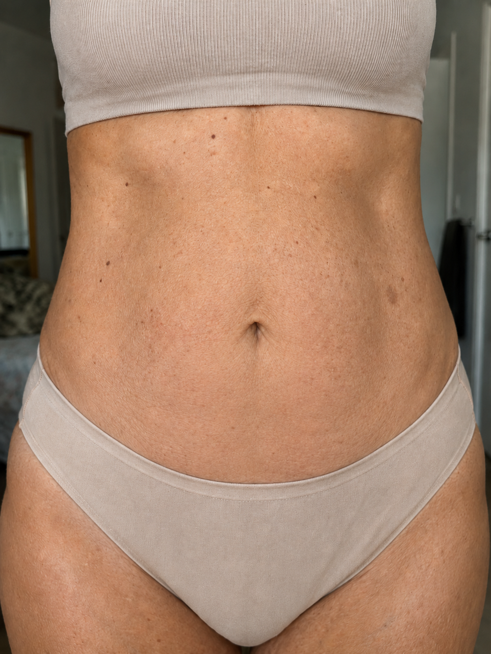 Before image